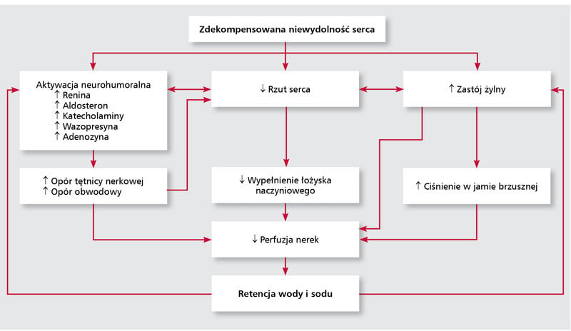Rycina 1. Patomechanizm retencji płynów i sodu u chorych ze zdekompensowaną niewydolnością serca.