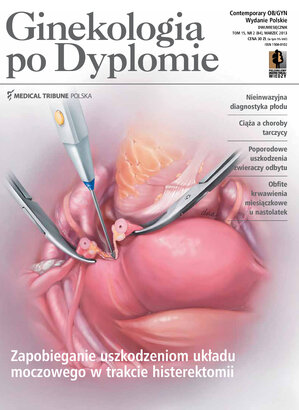 Ginekologia po Dyplomie 02/2013