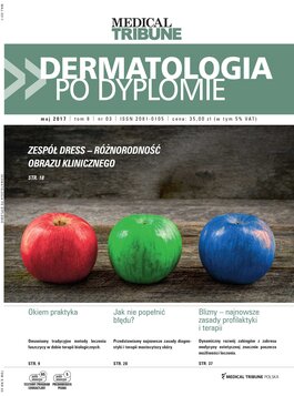 Dermatologia po Dyplomie (03/2017) 
