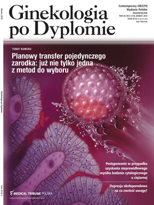 Ginekologia po Dyplomie 02/2018