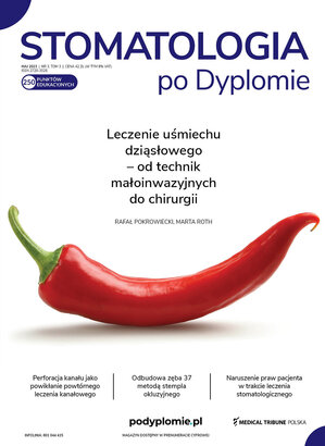 Medical Tribune - stomatologia 03/2023