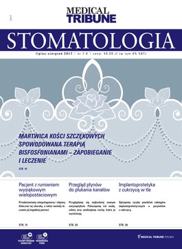 Medical Tribune - stomatologia (07-08/2017) 