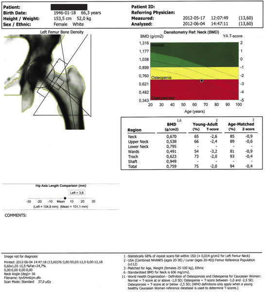 Rycina 1 i 2. Badania densytometryczne