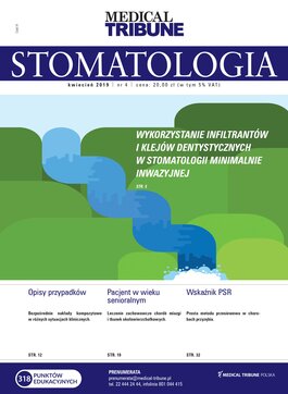 Medical Tribune Stomatologia (04/2019) 