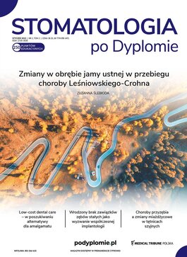 Stomatologia po Dyplomie (01/2022) 