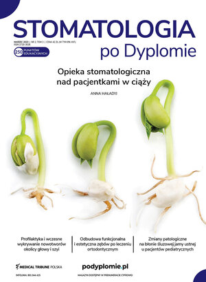 Medical Tribune Stomatologia 02/2023