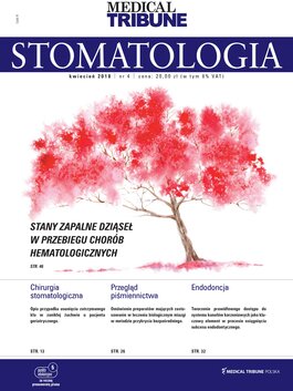 Stomatologia po Dyplomie (04/2018) 