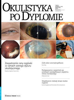 Okulistyka po Dyplomie 02/2014