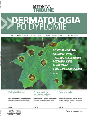 Dermatologia po Dyplomie 02/2017