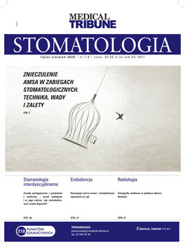 Medical Tribune Stomatologia (07-08/2020) 