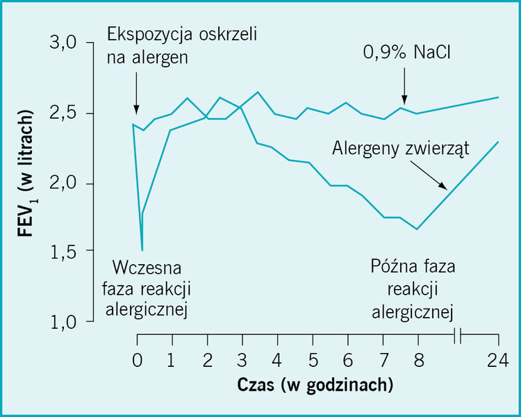  Rycina. Inhalacja całej cząsteczki alergenu