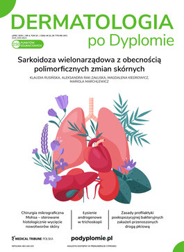 Dermatologia po Dyplomie (04/2025) 