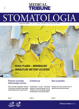 Medical Tribune Stomatologia (01/2018) 