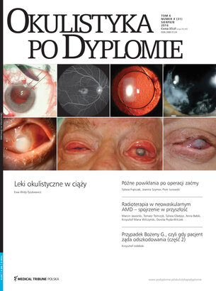 Okulistyka po Dyplomie 04/2016