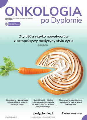 Onkologia po Dyplomie 02/2021