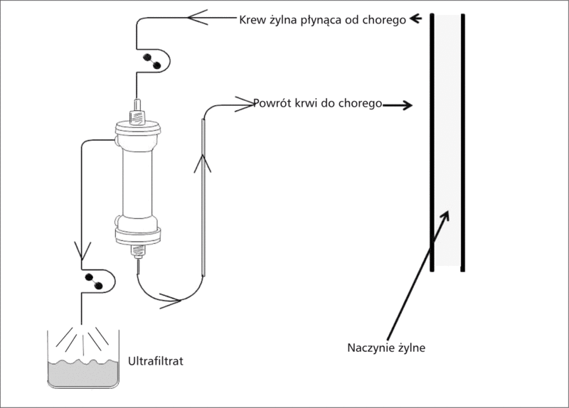 Rycina 3. Schemat ultrafiltracji.