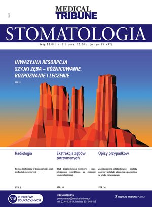 Medical Tribune - stomatologia 02/2019