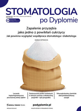 Medical Tribune Stomatologia (05/2023) 