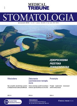 Medical Tribune Stomatologia (09/2018) 