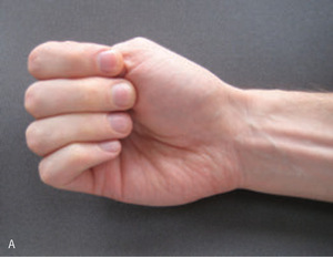 Small original 16639