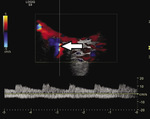 Small ryc 1 opt