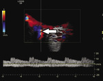 Small ryc 1 opt