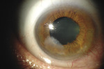 Small rycina 1 opt