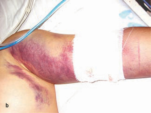 Small original 24467