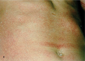 Small original 24434