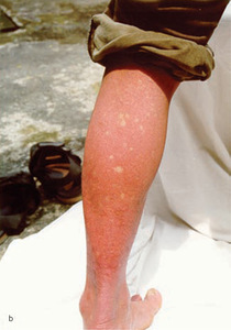 Small original 24846