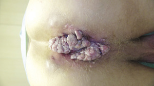 Small fot 1 k%c2%b3ykciny olbrzy opt