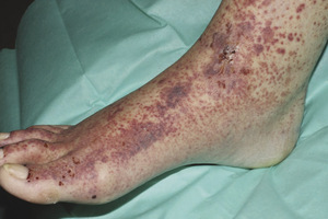 Small natarajan ryc 1 opt