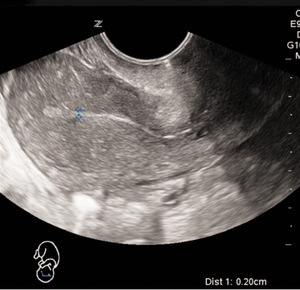 Small keder ryc1 opt