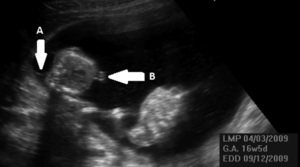 Small %c5%9awi%c4%85tkowskia ryc1 opt