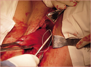 Small poreba ryc2 opt