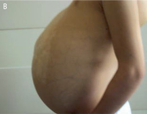 Small 23440