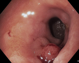 Small ryc 04 typ wyniosly ra opt