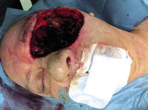 Small zdj%c3%aacie 3 opt