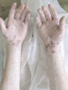 Small ryc.1 kopia opt