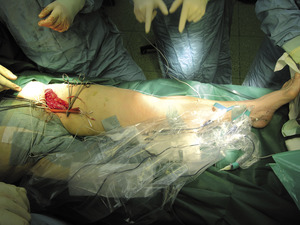 Small 01 obraz 070 opt