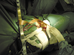 Small 03 obraz 073 opt