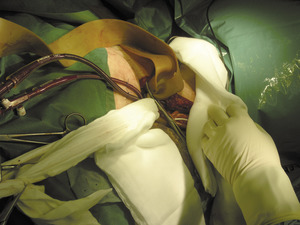 Small 04 obraz 074 opt