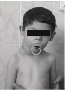 Small perek chloniak ryc1 opt