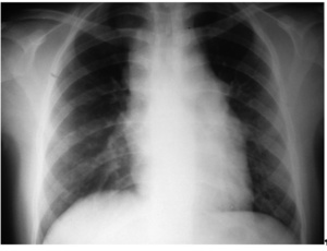 Small perek chloniak ryc2 opt