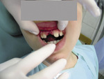 Small 01 opt