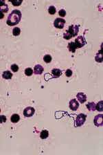 Small 01 streptococcus virid opt