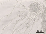 Small 02 candida albicans opt