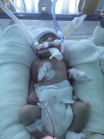 Small maks po urodzeniu opt