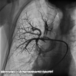 Small po cewniku bitmap opt