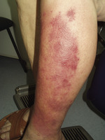 Small r%c3%b3%c5%bca opt